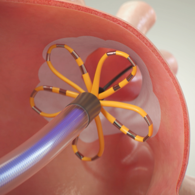 Descubra y conozca cómo funciona el sistema de PFA.